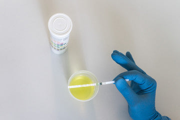 La Permanenza del THC nelle Urine e nel Fegato: L'Importanza di Depurarsi